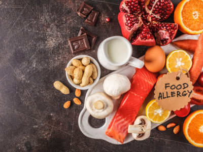 Food Allergen Training – Level 2