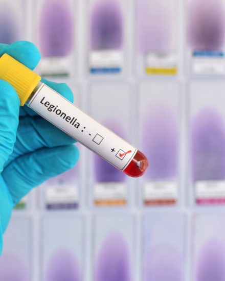 Legionella Awareness